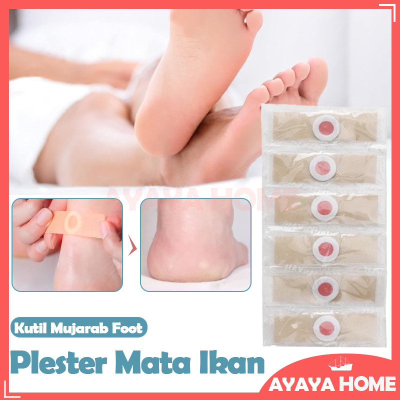 Plester Mata Ikan/Mata Ikan Penghilang Kutil/Plester Obat Kutil