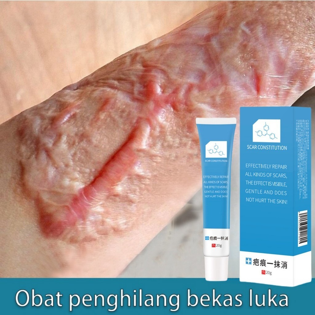 COD Scar removing cream penghilang bekas luka lama/Penghilang Bekas Luka/penghilang bekas luka koren