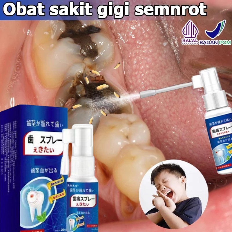 Obat sakit gigi Obat sakit gigi berlubang Obat sakit gigi semprot Obat sakit gigi ampuh Obat sariawa