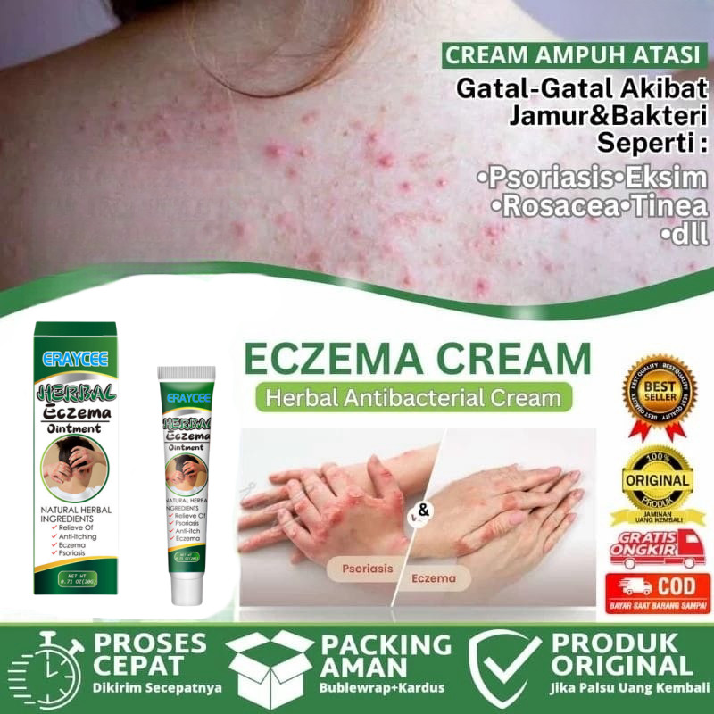 Salep gatal Salep Eksim Salep kulit Krim psoriasis Eczema Psoriasis Treatment Ointment Antibacterial