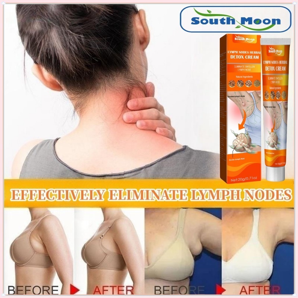 South Moon LYMPH NODES HERBAL DETOX CREAM Lymph Detoxification Cream obat benjolan lipoma obat benjo