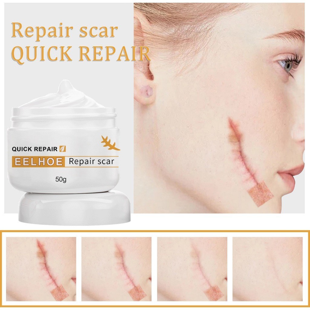 EELHOE Surgical Scar Repair Cream 50g Bakar Penghilang Bekas Luka Operasi Keloid Bekas Luka Krim Sal
