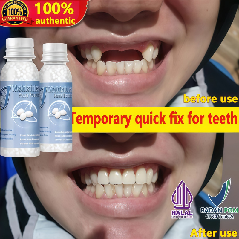 30ML Penambal gigi berlubang gigi palsu asli dokter permanen tambal gigi permanen  lem gigi palsu pe