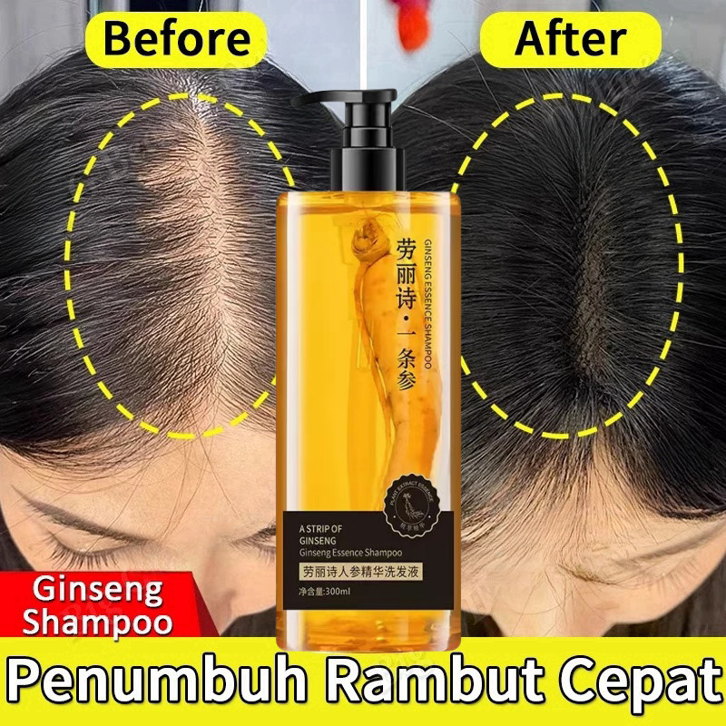 shampoo penumbuh rambut cepat Ginseng Shampoo shampoo penumbuh rambut Shampoo Anti Rontok shampoo ra
