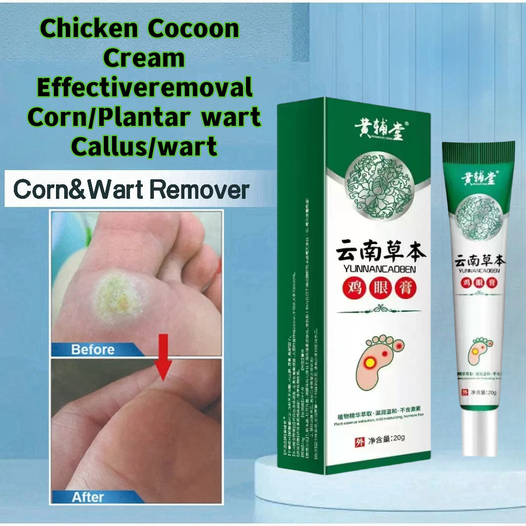 AMND Salep Mata Ikan Ampuh Obat Mata Ikan Kaki Penghilang Mata Ikan Obat Penghilang Kutil Dan Tahi