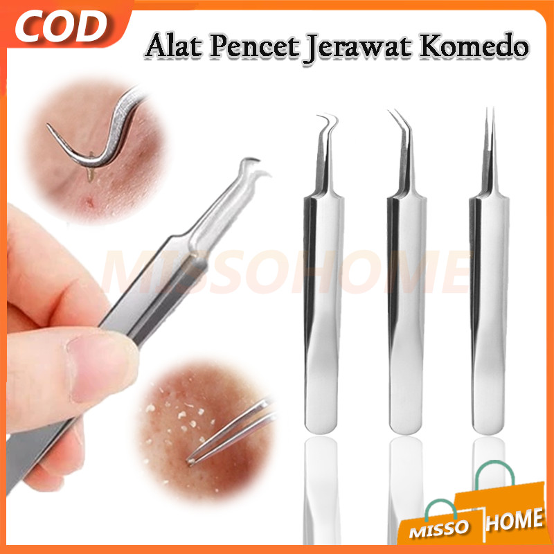 Pinset Komedo Alat Pembersih Pencabut   / Jepitan Komedo / Pembersih Pori / Pinset Jerawat / Alat Pe