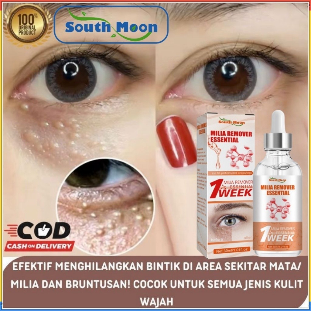 South Moon milia remover serum penghilang milia 7 days Serum Penghilang Milia Kutil di bawah Mata Ey