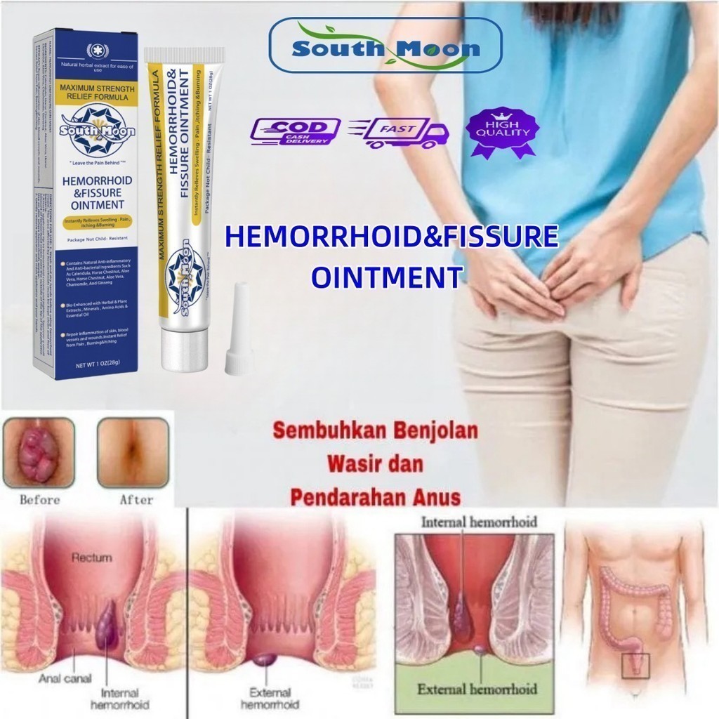 South Moon Obat Wasir/Obat Ambeien Salep Ambeien Paling Ampuh Salep Ambeien/Obat Ambeien Paling Ampu