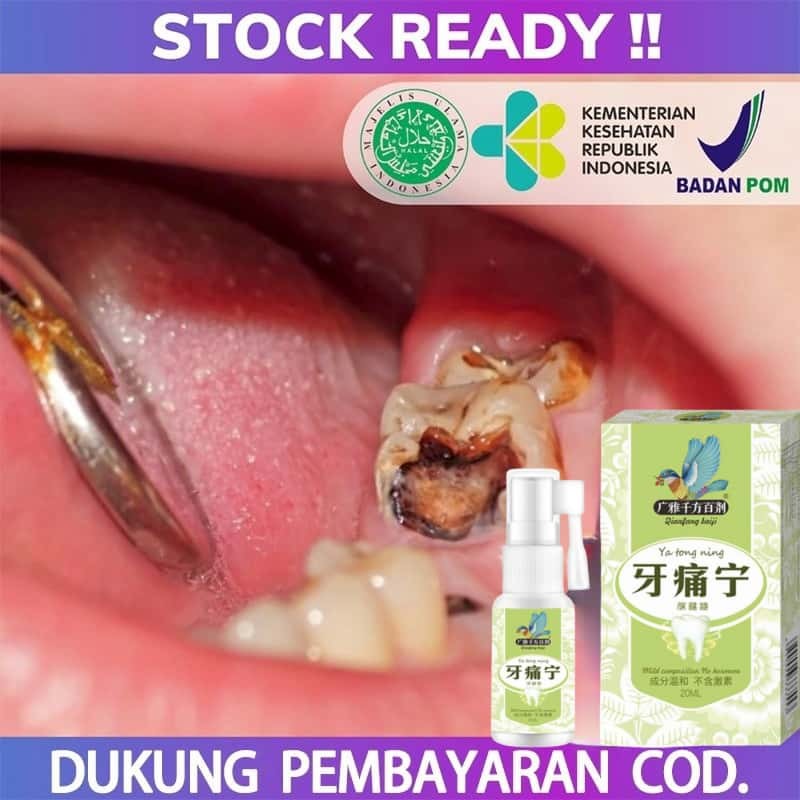 Obat Gigi Berlubang, Penghancur gigi berlubang, gigi sering nyut nyutan, Gusi Bengkak, Gigi Ngilu, R