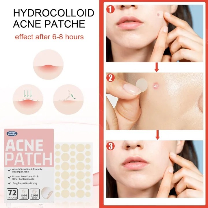 Asam asilat 72 stiker jerawat jerawat jerawat jerawat jerawat