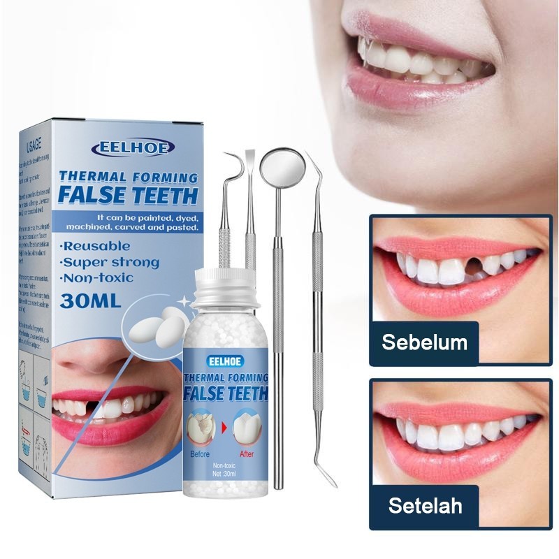 [100% Original] Gigi Palsu Penambal gigi berlubang Gigi palsu asli dokter permanen Tambalan gigi