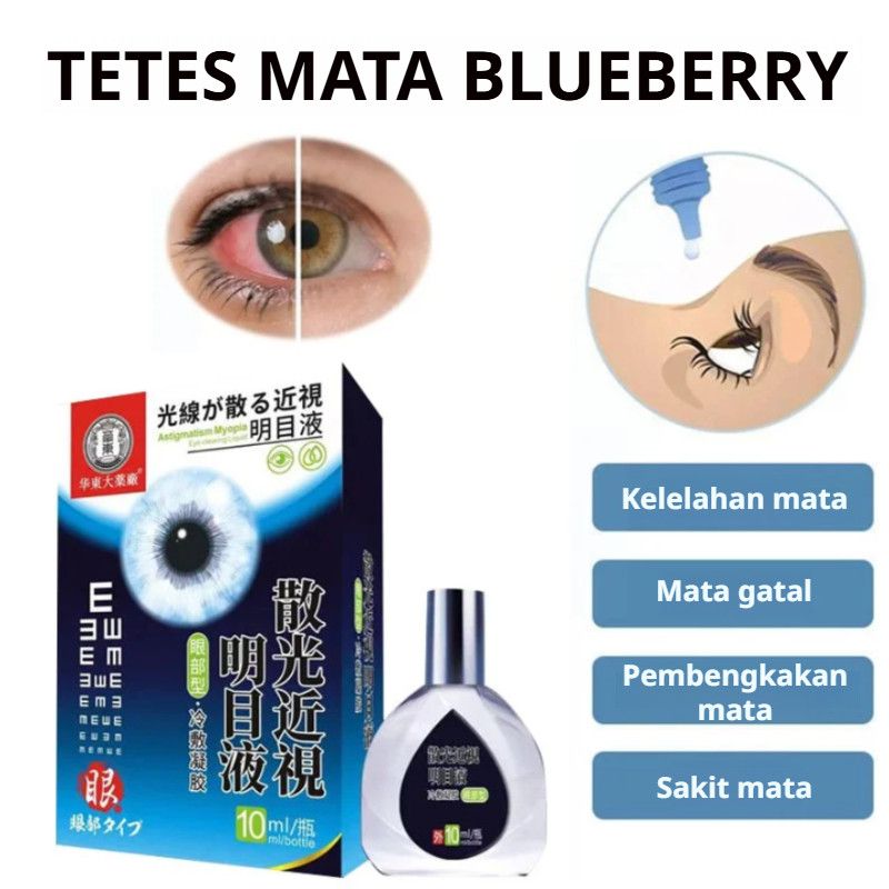 Kirim dalam 24 jam/Obat Mata Katarak/Obat Tetes Mata/Tetes Mata Katarak/Obat Tetes Mata Katarak/Obat