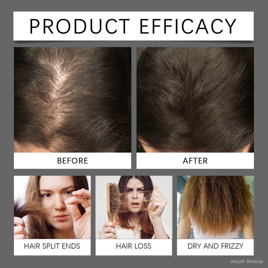 

Hoegoa Hair Care Serum Moisturizing Hydrating Strengthening Volumizing Hair Care Daily Scalp Care