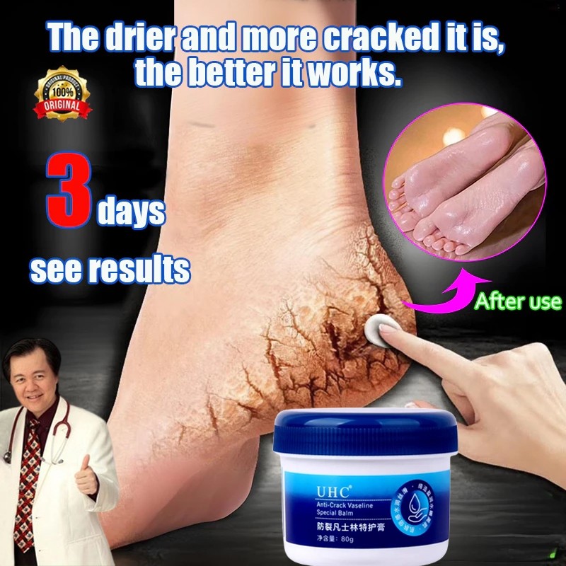 Vaseline cream kaki pecah dan kering Obat kaki pecah pecah 80g obat kaki pecah krim kaki pecah dan k