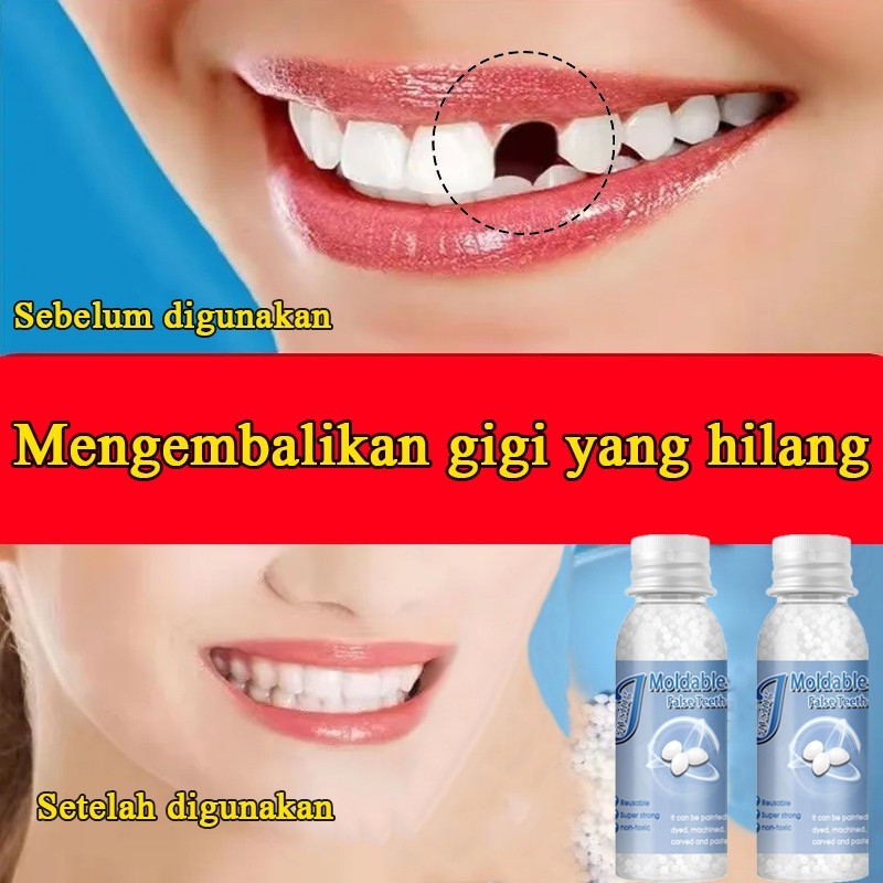 【COD】gigi ompong palsu，bahan tambal gigi berlubang，butir penambal gigi berlubang，buat gigi berlubang