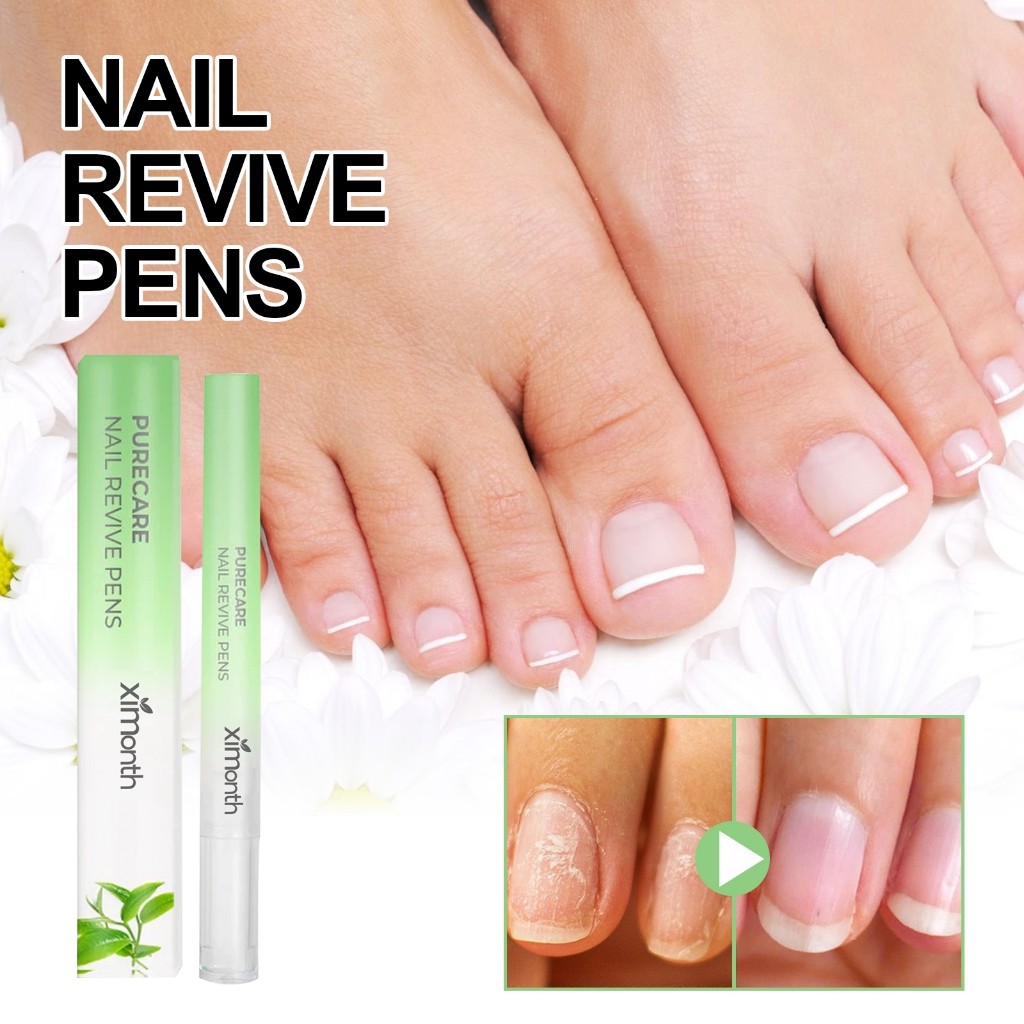 Ximonth Nail Repair Pen Pena Perbaikan Kuku Vitamin Kuku Mengkilap Vitamin Kuku Kering Dan Rusak Kuk