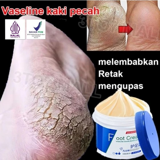 Vaseline kaki pecah dan kering Foot cream Obat kaki pecah Pelembab kaki kering dan pecah Penghalus k