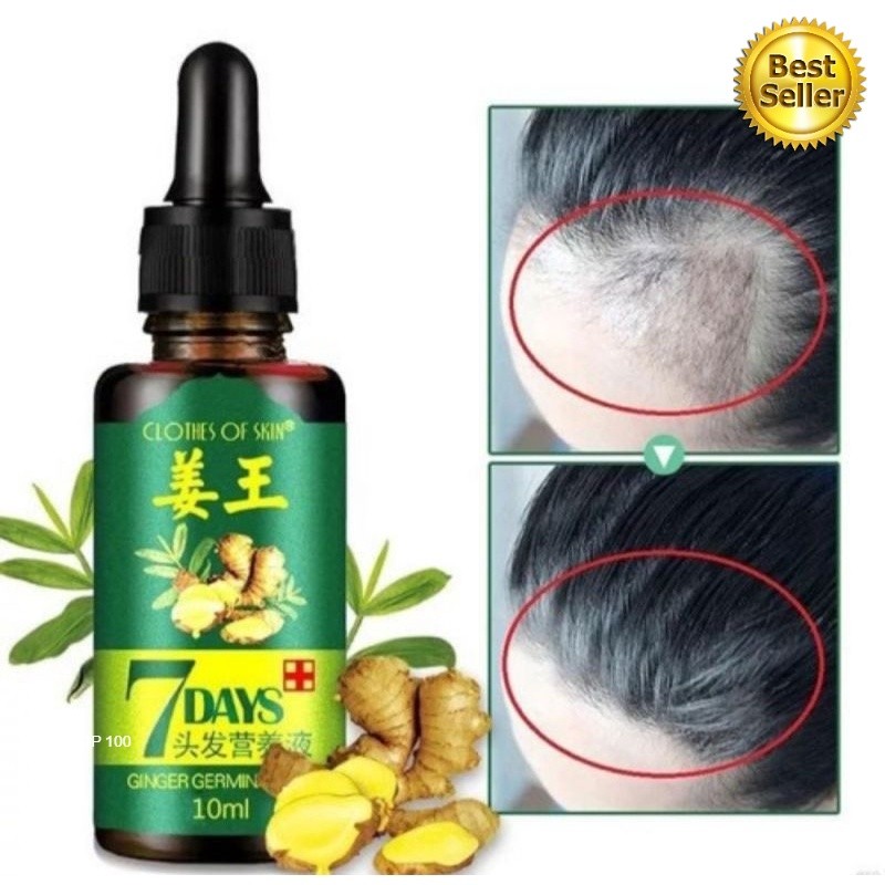 PENUMBUH RAMBUT BOTAK DAN RONTOK PRIA ANAK BAYI CEPAT SERUM ESSENCE Penghitam Uban Penyubur Original