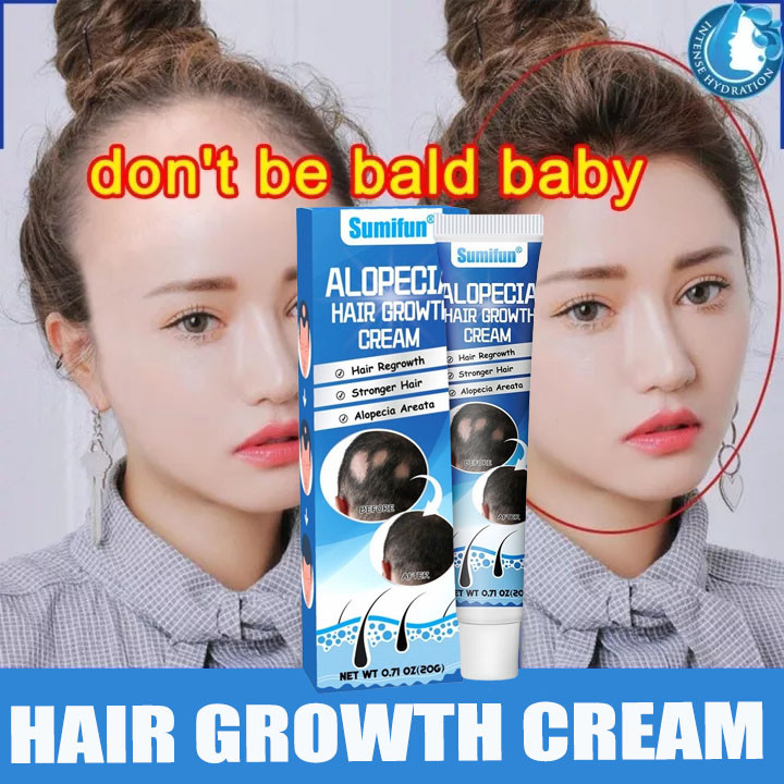 Salep Penumbuh Rambut untuk Alopecia Areata dan Rambut Pitak 20g