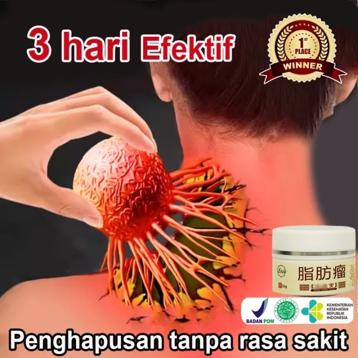 

Lipoma 100% asli dan autentik eliminasi lipoma benjolan di tangan obat benjolan di leher Benjolan di bahu dan punggung benjolan di ketiak benjolan di kaki Gondongan Gondongan beracun Tiroid Kelenjar Limfoma 30g JS[ PAKETAN ]