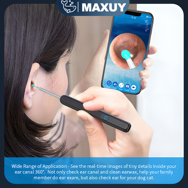 Pembersih telinga bayi korek kuping LED kamera WiFi hp korek kuping bayi pembersih kuping smart