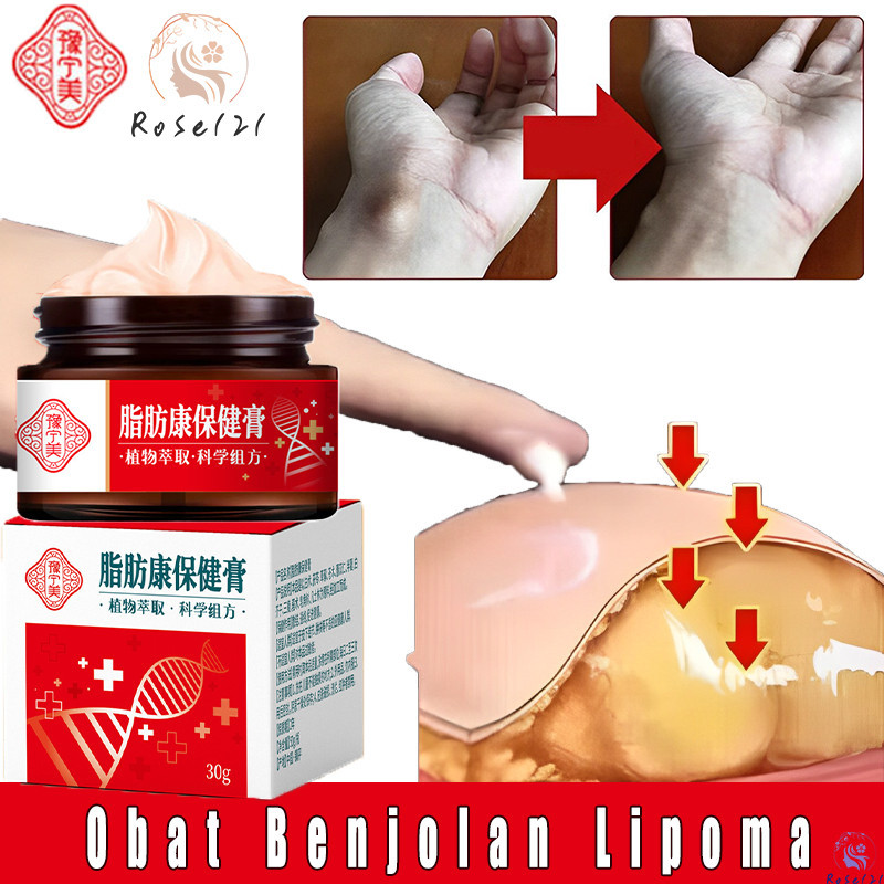Lipoma Cream Original / Lipoma Removal Cream / Obat Benjolan / Obat Lipoma / Salep Benjolan / Salep 