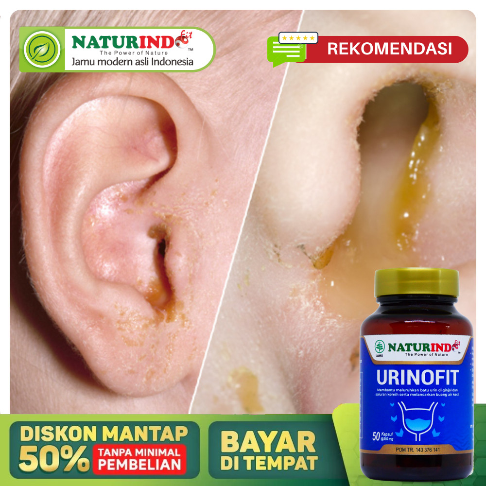 Obat Telinga Congek Anak Dan Dewasa Paling Ampuh Atasi Telinga Berair Congek Menahun Cairan Bau Bern