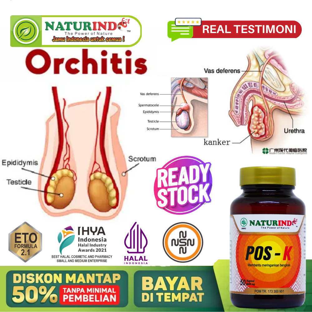 Obat Orchitis Paling Ampuh, Orkitis, Radang Testis, Buah Zakar Bengkak, Nyeri Testis, Benjolan Di Bu