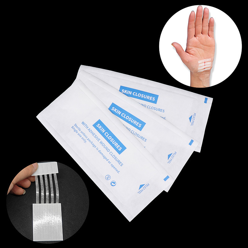 Sterile Strip Scar Away Acne Scar Marks Remover Sterile First Aid Travel Wound Skin Closures Medical