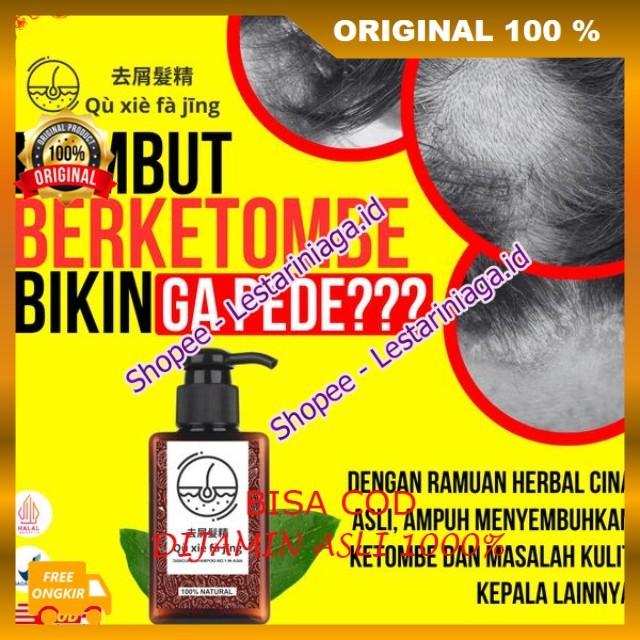 Qu Xi Fa Jing Shampoo Herbal Cina Atasi Ketombe, Rambut Rontok , Lepek, Bercabang Gatal Dan Jamur Am