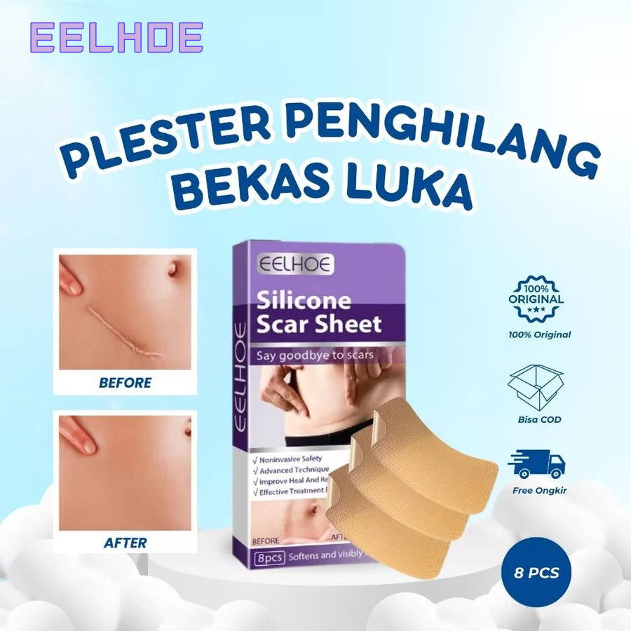 EELHOE Silicone Keloid Keloplast Silicone Keloid Plester Scar Tape Keloid Bekas Luka 8pcs(4 Cm X 7.5