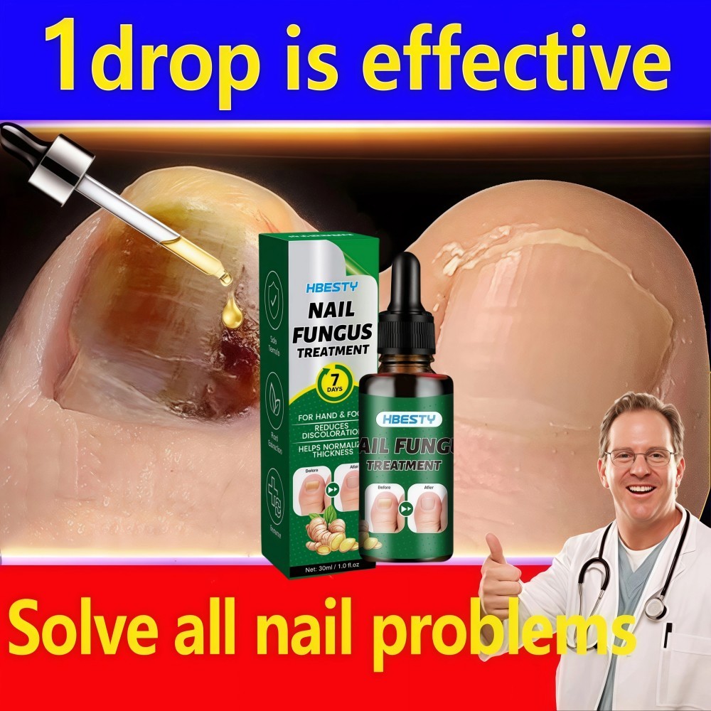 "Obat Kuku Anti Infeksi Jamur Bakteri Cantengan Bau Busuk gatal Menguning Bernanah Sakit Bengkak Men