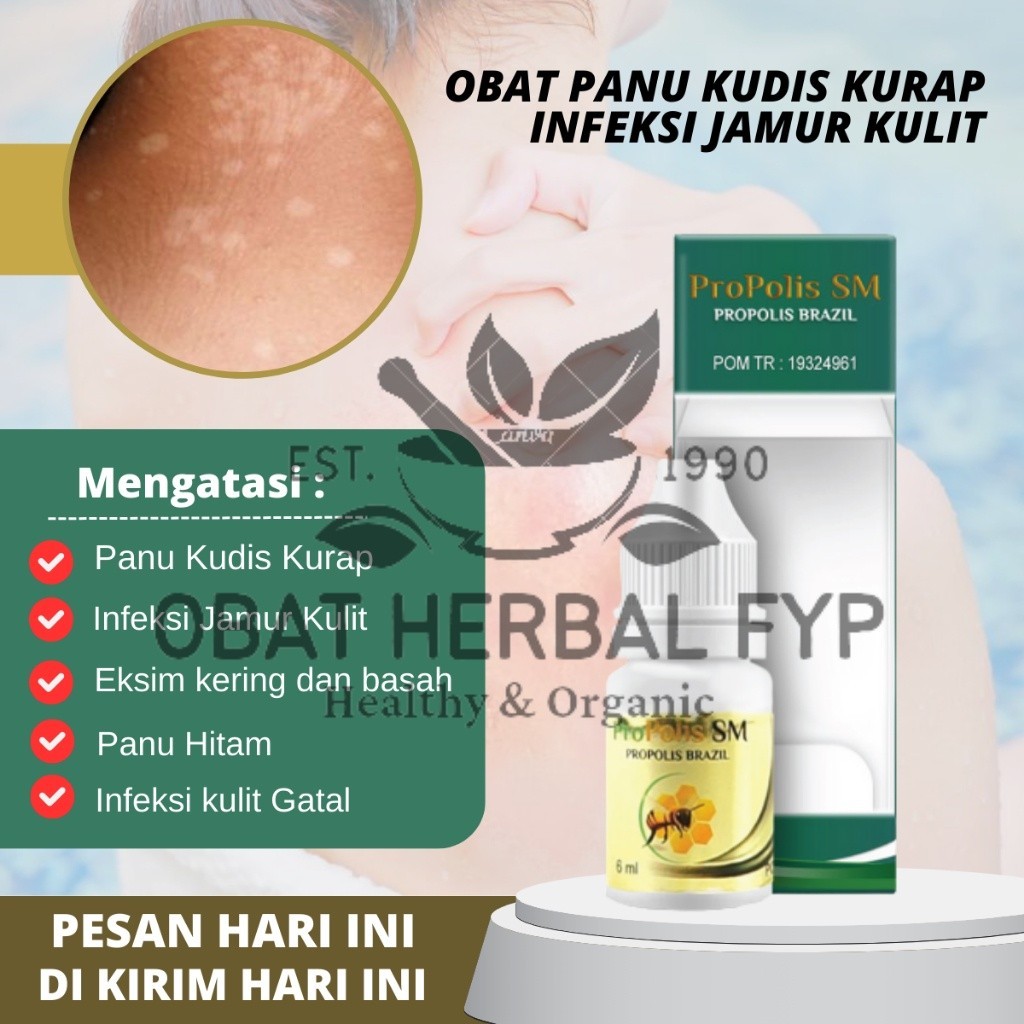Obat Panu, Obat Jamur Kulit, Salep jamur Kulit,  Obat Panu Anak Dan Dewasa, Penghilang Panu, Obat Pa