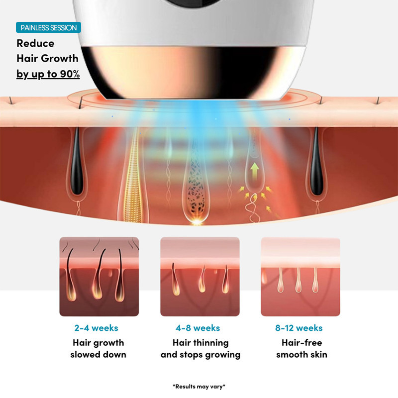 New IPL Laser Hair Removal Penghapusan Rambut Permanen Portable IPL Laser Hair Removal Permanent