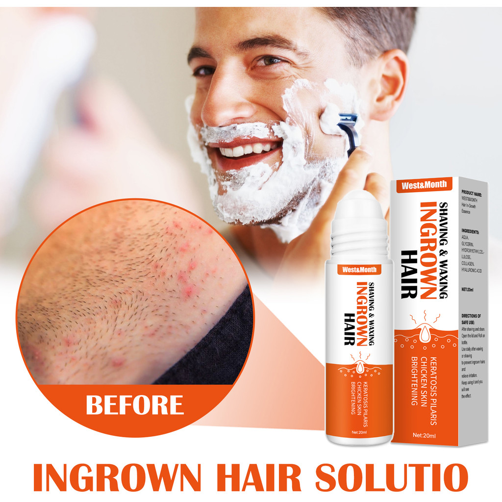 

Rambut Serum Roll-On Rambut Setelah Cukur&West Melembapkan Harian Menenangkan Month Esensi Perawatan Kulit