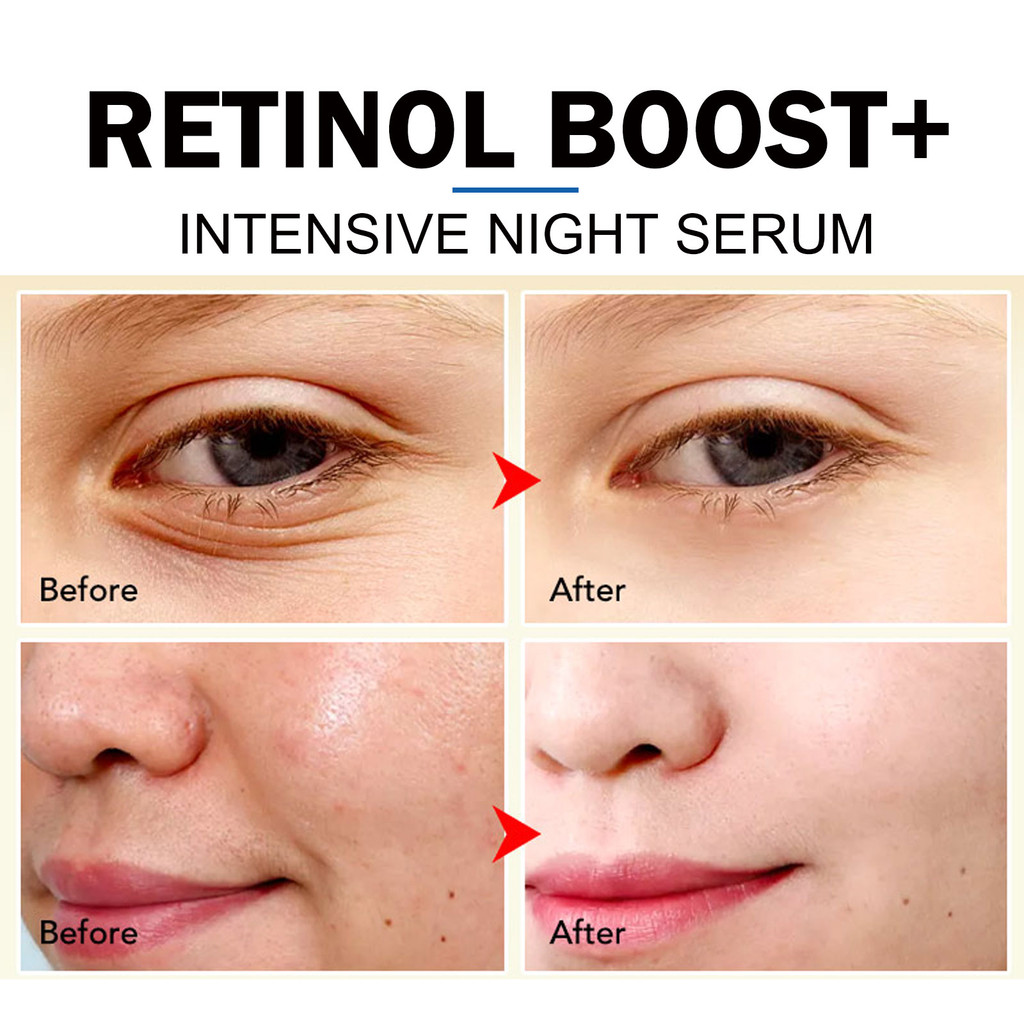 

Serum Anti-Penuaan Retinol Hoygi yang Menghidrasi, Melembapkan, Mengencangkan Kulit, Anti-Penuaan, Memudarkan Noda, dan Garis Halus