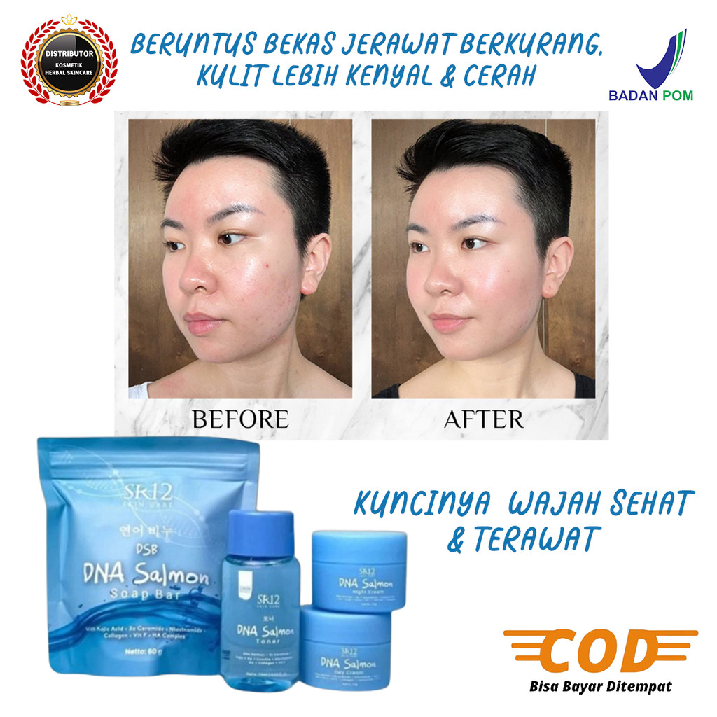 DNA Salmon Pemutlh Wajah Sr12 Paket Skincare DNA Salmon Sr12 Untuk Flek Hitam Dan Berjerawat BpomOri