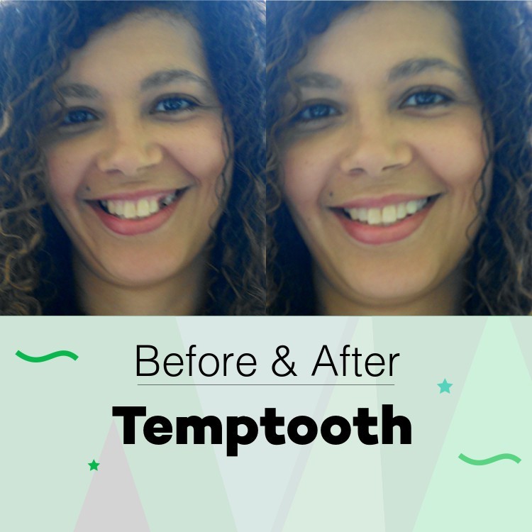 PROMO TEMPTOOTH 200 BUTIR MURAH ORIGINAL / TEMTOOTH / Gigi Temporary / Penambal Gigi / Gigi Palsu