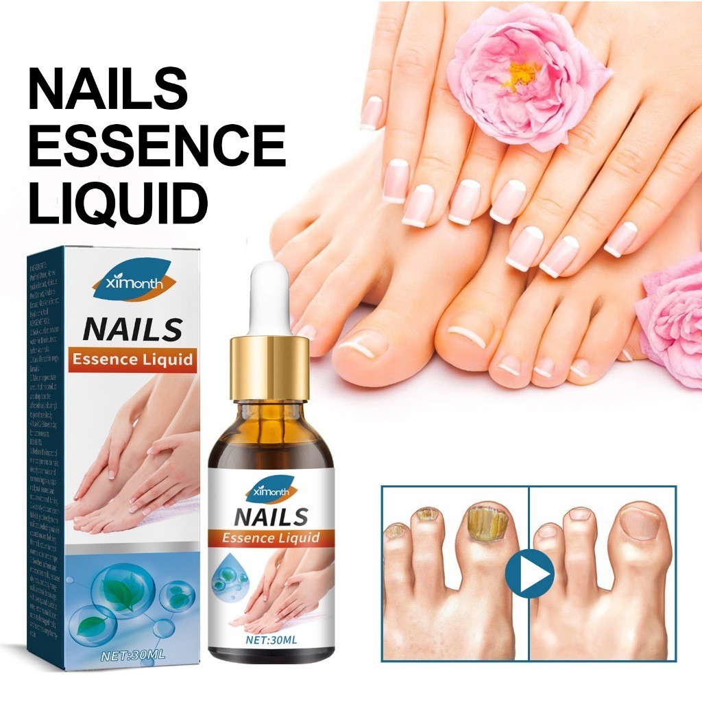 Ximonth Serum Kuku Jamur Dan Rusak 30ml Serum Kuku Berjamur Perawatan Kuku Rusak