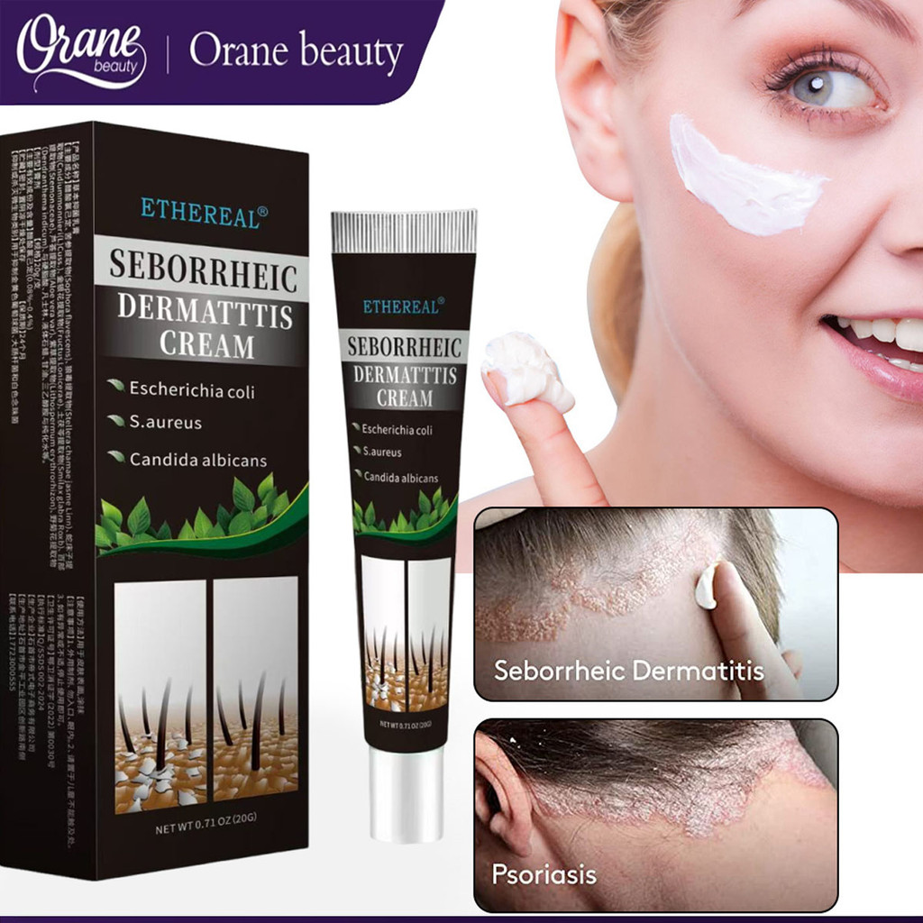 Oranebeauty 20g gram Psoriasis Flakes dan Penghilang Ketombe Krim Ketombe Dermatitis Seboroik Dermat