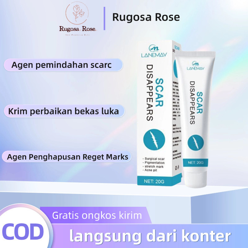 Penghilang bekas luka hitam koreng Penghilang bekas luka di kaki Penghilang Bekas cacar Bekas gigita