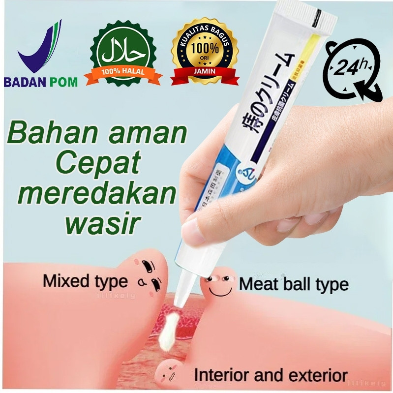 Murah dan asli Obat ambeien Salep ambeien paling ampuh salep ambeien 20g/obat ambeien paling ampuh