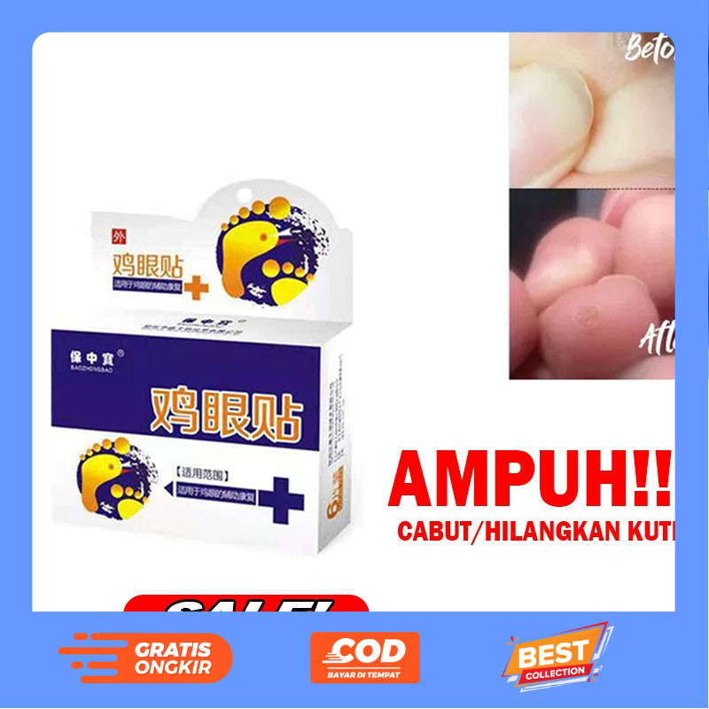 [ ISI 6 PCS  ] Obat Plester Kutil Mata Ikan Ampuh Mengobati Kutil dan Kapalan Kaki