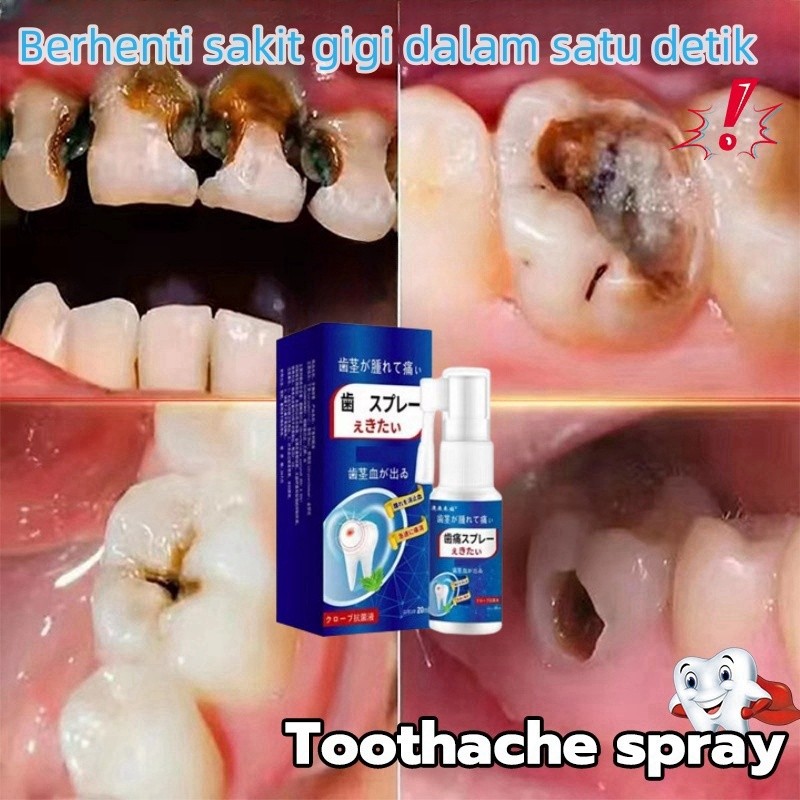 Obat Sakit Gigi Berlubang Paling Ampuh，Obat sakit gigi semprot semprotan pereda nyeri obat sakit gig