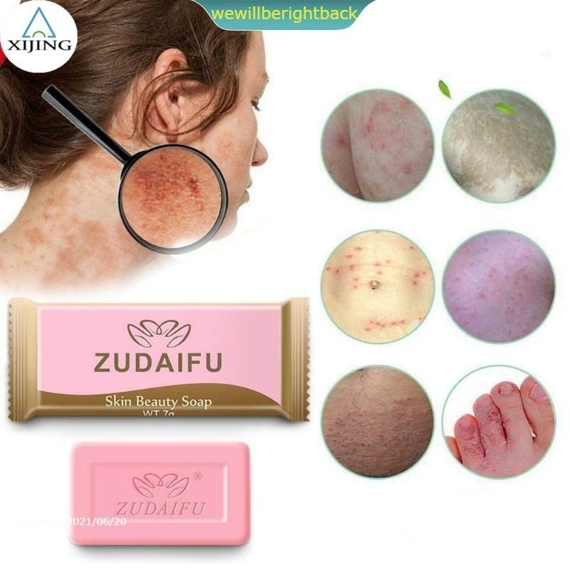 Yiganerjing Sabun Sulfur penyakit eksim anti bakteri psoriasis dermatitis kudis kurap panu jamur A M