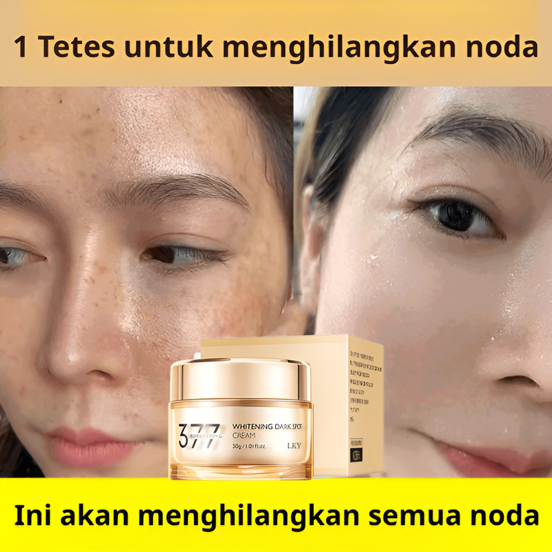 Kirim dalam 24 jam/377 Cream Flek Hitam Membandel Cream Pemutihan Penghilang Flek Hitam 30g Wajah Gl