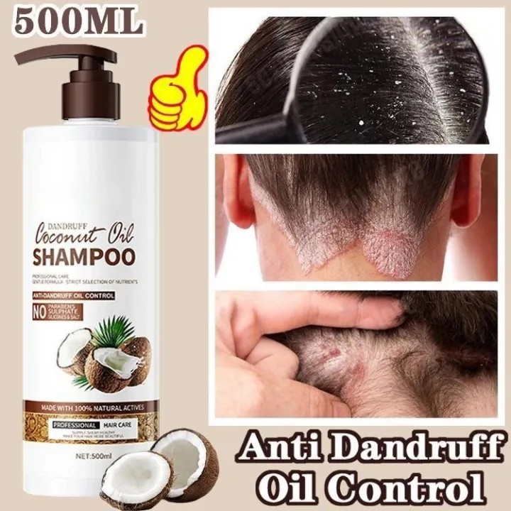 SADOER Ekstrak Kelapa Oil control Shampo anti ketombe Penghilang Ketombe Berkerak Dan Gatal obat ket