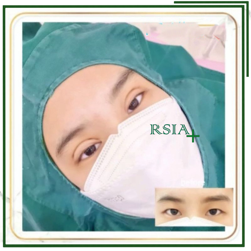 Duk Lubang Operasi Wajah 60x60 Duk Bolong Operasi 60 x 60 RSIA