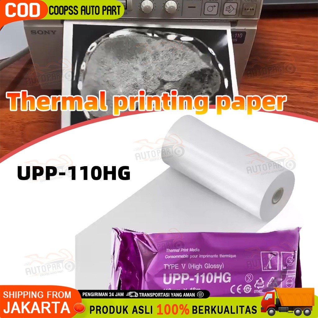 

NEW Siap dalam stok kertas thermal Paper printer usg Kertas USG Kertas termal ultrasonik - UPP 110HG