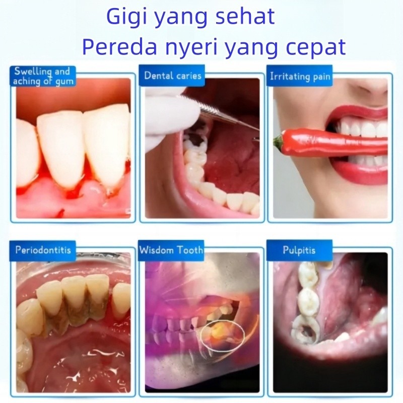 AZO1 Obat sakit gigi semprot semprotan pereda nyeri obat sakit gigi berlubang obat sakit gigi